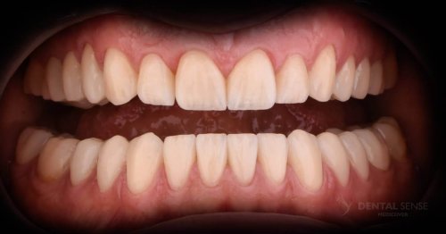 DSM_Metamorfoza_105_IMG_08