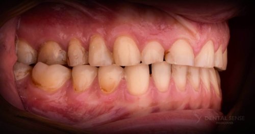 DSM_Metamorfoza_105_IMG_09