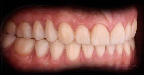 DSM_Metamorfoza_105_IMG_10