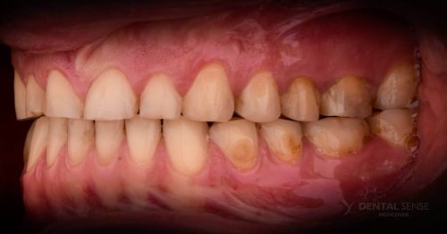 DSM_Metamorfoza_105_IMG_11