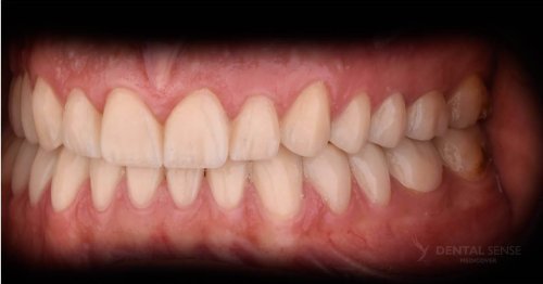 DSM_Metamorfoza_105_IMG_12